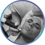 icon_150x150_microdermabrasion
